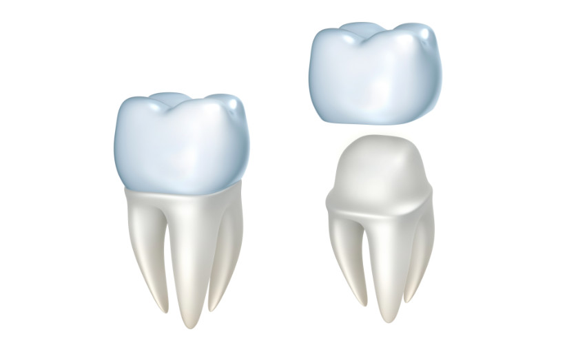 crowns