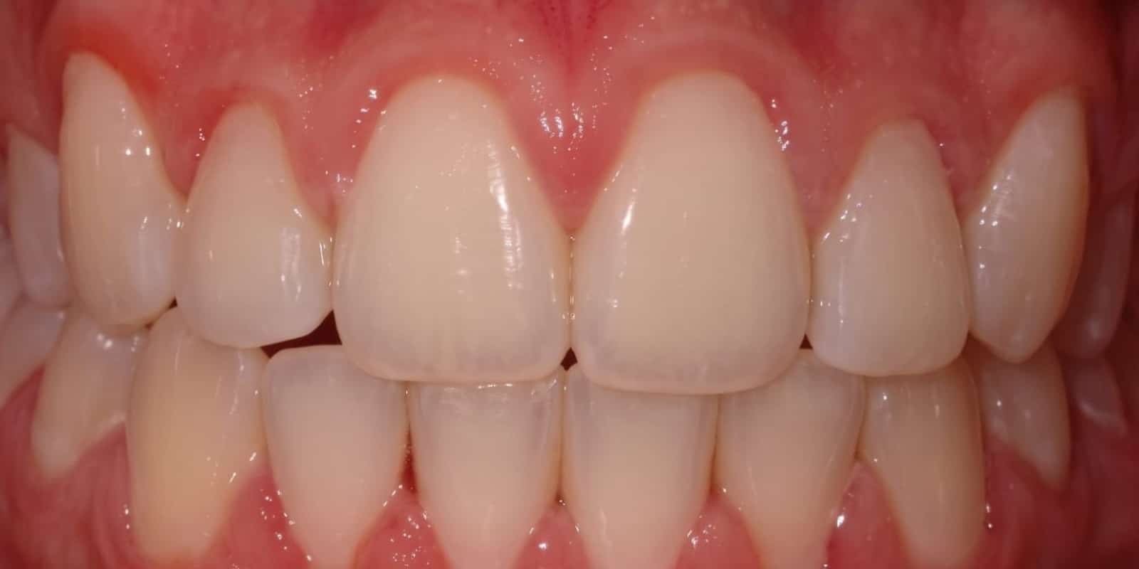 Smile after treatment at The Tooth Spa, Leeds