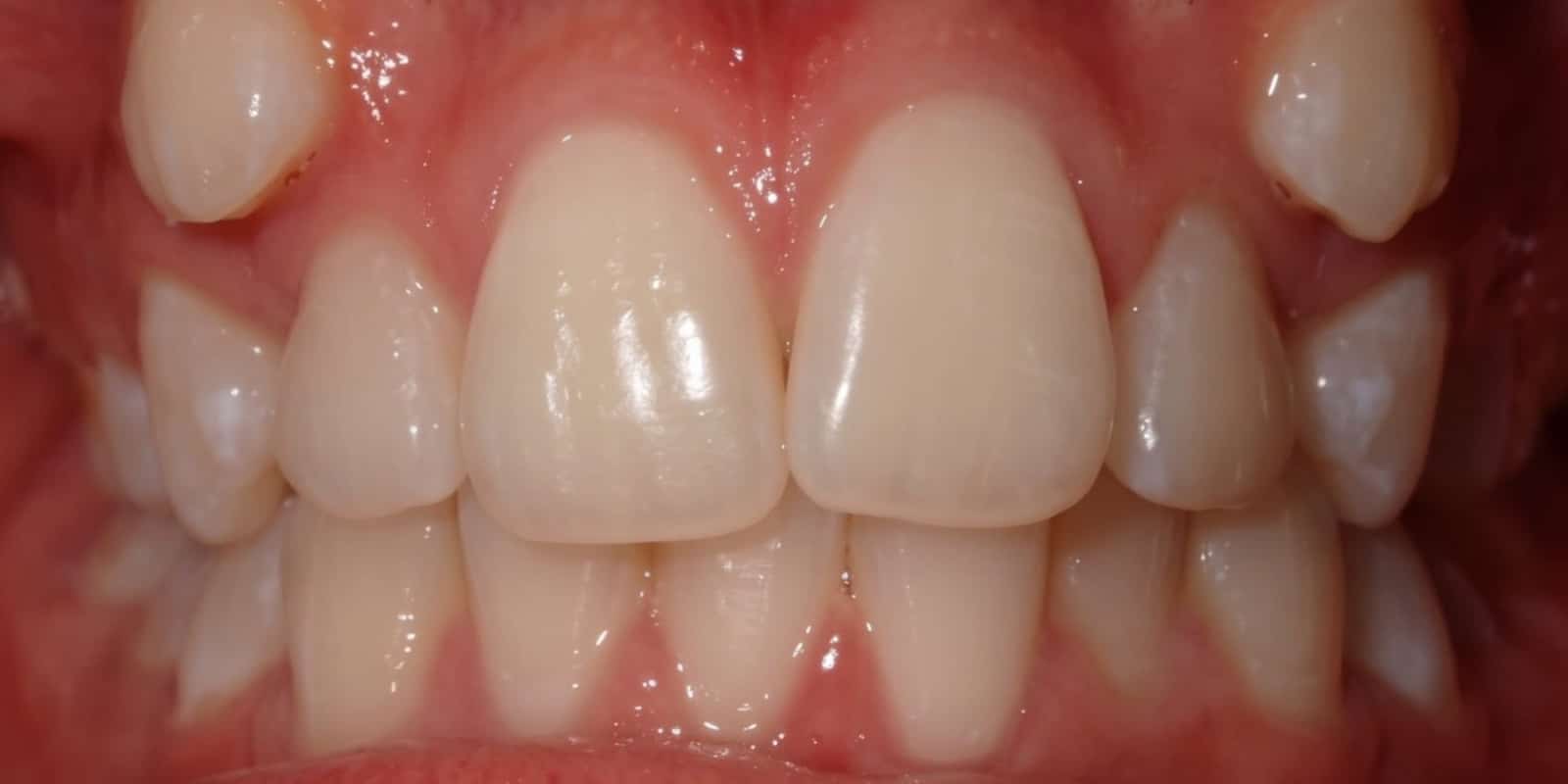 Smile before treatment at The Tooth Spa, Leeds